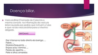 Doença biliar.
 Vesícula Biliar Chamada de Coleciste a
mesma consiste na inflamação da vesícula
biliar causada por pedras que instruem o tubo
e que vai da vesícula biliar para o intestino
delgado.
Dor intensa no lado direito da barriga. ...
Febre. ...
Diarreia frequente. ...
Enjoos e/ou vômitos. ...
Perda do apetite. ...
Pele e olhos amarelos
SINTOMAS
 