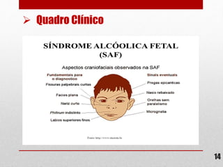 14
 Quadro Clínico
 