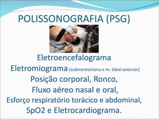 POLISSONOGRAFIA (PSG) Eletroencefalograma  Eletromiograma  (submentoniana e m. tibial anterior) Posição corporal, Ronco,  Fluxo aéreo nasal e oral, Esforço respiratório torácico e abdominal, SpO2 e Eletrocardiograma. 