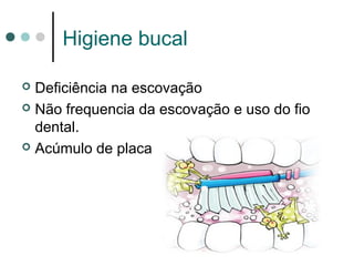 Higiene bucal
 Deficiência na escovação
 Não frequencia da escovação e uso do fio
dental.
 Acúmulo de placa
 