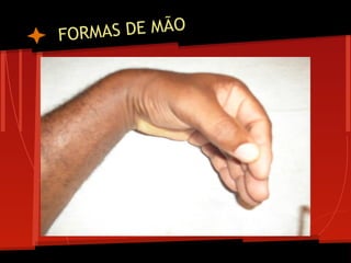 FORMAS DE MÃO
 