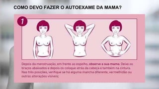COMO DEVO FAZER O AUTOEXAME DA MAMA?
 