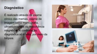 Diagnóstico
É realizado através de exame
clínico das mamas, exame de
imagem como mamografia,
ultrassonografia ou ressonância
magnética. A confirmação
diagnóstica só é feita, por meio da
biópsia.
 