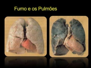 Fumo e os Pulmões 
 