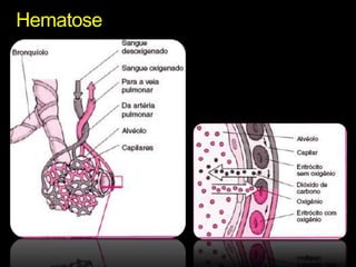 Hematose 
 
