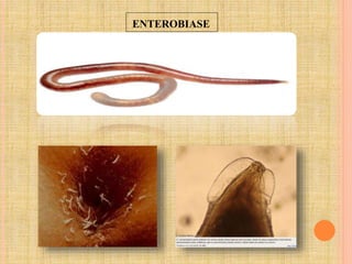 ENTEROBIASE
 