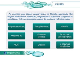  A síndrome nefrótica é a forma de apresentação de várias doenças renais que se manifestam por edema generalizado e proteinúria.CAUSASAs doenças que podem causar lesão na filtração glomerular têm origens inflamatória, infecciosa, degenerativa, obstrutiva, congênita ou neoplásica. Entre as principais causas da síndrome nefróticaestão:Hepatite B;Diabetes Mellitus;Trombose Venosa Renal;Esquistossomose;Toxoplasmose;Malária;Drogas;AIDS;e algumas neoplasias.