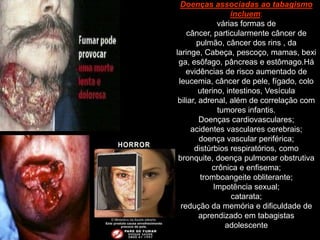 Doenças associadas ao tabagismo
                   incluem:
               várias formas de
    câncer, particularmente câncer de
        pulmão, câncer dos rins , da
laringe, Cabeça, pescoço, mamas, bexi
 ga, esôfago, pâncreas e estômago.Há
    evidências de risco aumentado de
 leucemia, câncer de pele, fígado, colo
         uterino, intestinos, Vesícula
 biliar, adrenal, além de correlação com
               tumores infantis.
         Doenças cardiovasculares;
      acidentes vasculares cerebrais;
         doença vascular periférica;
       distúrbios respiratórios, como
 bronquite, doença pulmonar obstrutiva
             crônica e enfisema;
          tromboangeite obliterante;
              Impotência sexual;
                    catarata;
  redução da memória e dificuldade de
         aprendizado em tabagistas
                 adolescente
 