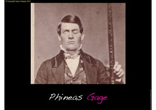 © Copyright Vasco Gaspar, 2011




                                                Image:http://www.ask.com/wiki/Phineas_Gage
                                 Phineas Gage
 