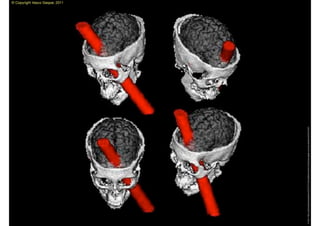 © Copyright Vasco Gaspar, 2011




Image: http://psicocafe.blogosfere.it/2007/01/lincredibile-storia-di-phineas-gage-e-la-sua-sbarra-di-ferro.html
 