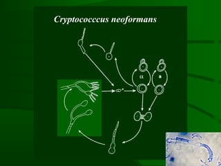 Cryptococccus neoformans
 