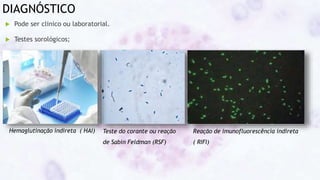 DIAGNÓSTICO
 Pode ser clinico ou laboratorial.
 Testes sorológicos;
Teste do corante ou reação
de Sabin Feldman (RSF)
Hemaglutinação indireta ( HAI) Reação de imunofluorescência indireta
( RIFI)
 