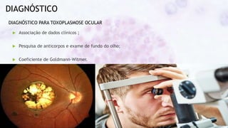 DIAGNÓSTICO
 Associação de dados clínicos ;
 Pesquisa de anticorpos e exame de fundo do olho;
 Coeficiente de Goldmann-Witmer.
DIAGNÓSTICO PARA TOXOPLASMOSE OCULAR
 