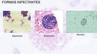FORMAS INFECTANTES
Taquizoítos Bradizoítos
Oocistos
 