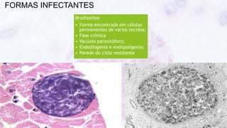 FORMAS INFECTANTES
Bradizoítos
• Forma encontrada em células
permanentes de vários tecidos;
• Fase crônica
• Vacúolo parasitóforo;
• Endodiogenia e endopoligenia;
• Parede do cisto resistente
 