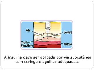 A insulina deve ser aplicada por via subcutânea
com seringa e agulhas adequadas.
 