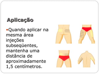 •Quando aplicar na
mesma área
injeções
subseqüentes,
mantenha uma
distância de
aproximadamente
1,5 centímetros.
AplicaçãoAplicação
 