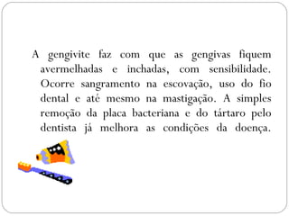 A gengivite faz com que as gengivas fiquem
avermelhadas e inchadas, com sensibilidade.
Ocorre sangramento na escovação, uso do fio
dental e até mesmo na mastigação. A simples
remoção da placa bacteriana e do tártaro pelo
dentista já melhora as condições da doença.
 