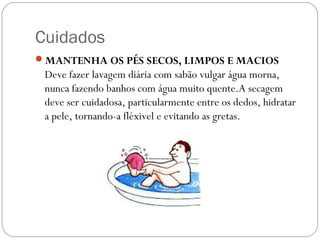 Cuidados
MANTENHA OS PÉS SECOS, LIMPOS E MACIOS
Deve fazer lavagem diária com sabão vulgar água morna,
nunca fazendo banhos com água muito quente.A secagem
deve ser cuidadosa, particularmente entre os dedos, hidratar
a pele, tornando-a fléxivel e evitando as gretas.
 