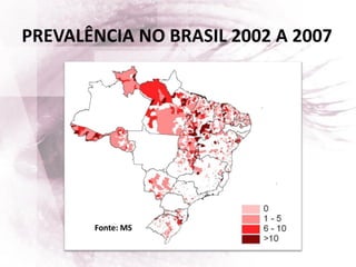 PREVALÊNCIA NO BRASIL 2002 A 2007
Fonte: MS
 