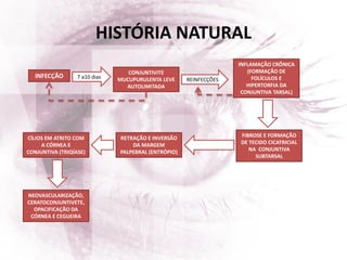 HISTÓRIA NATURAL
INFECÇÃO
CONJUNTIVITE
MUCUPURULENTA LEVE
AUTOLIMITADA
7 a10 dias REINFECÇÕES
INFLAMAÇÃO CRÔNICA
(FORMAÇÃO DE
FOLÍCULOS E
HIPERTORFIA DA
CONJUNTIVA TARSAL)
FIBROSE E FORMAÇÃO
DE TECIDO CICATRICIAL
NA CONJUNTIVA
SUBTARSAL
RETRAÇÃO E INVERSÃO
DA MARGEM
PALPEBRAL (ENTRÓPIO)
CÍLIOS EM ATRITO COM
A CÓRNEA E
CONJUNTIVA (TRIQÍASE)
NEOVASCULARIZAÇÃO,
CERATOCONJUNTIVETE,
OPACIFICAÇÃO DA
CÓRNEA E CEGUEIRA
 