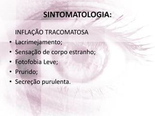 INFLAÇÃO TRACOMATOSA
• Lacrimejamento;
• Sensação de corpo estranho;
• Fotofobia Leve;
• Prurido;
• Secreção purulenta.
SINTOMATOLOGIA:
 
