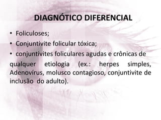 • Foliculoses;
• Conjuntivite folicular tóxica;
• conjuntivites foliculares agudas e crônicas de
qualquer etiologia (ex.: herpes simples,
Adenovírus, molusco contagioso, conjuntivite de
inclusão do adulto).
DIAGNÓTICO DIFERENCIAL
 