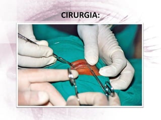 CIRURGIA:
 