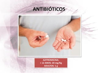 AZITROMICINA:
< 12 ANOS: 20 mg/Kg
ADULTOS: 1 g
ANTIBIÓTICOS
 