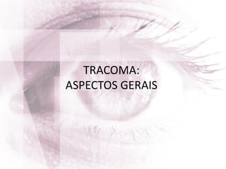 TRACOMA:
ASPECTOS GERAIS
 