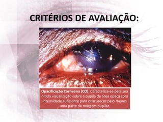 Opacificação Corneana (CO): Caracteriza-se pela sua
nítida visualização sobre a pupila de área opaca com
intensidade suficiente para obscurecer pelo menos
uma parte da margem pupilar.
CRITÉRIOS DE AVALIAÇÃO:
 