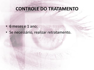 CONTROLE DO TRATAMENTO
• 6 meses e 1 ano;
• Se necessário, realizar retratamento.
 