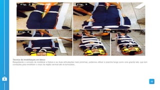 Técnica de imobilização em bloco:
Respeitando o conceito de imobilizar a fratura e as duas articulações mais próximas, podemos utilizar a prancha longa como uma grande tala, que tem
condições para imobilizar o corpo da região cervical até os tornozelos..
33
 