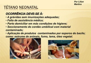 Por Lilian
Martins
TÉTANO NEONATAL
• A grávidas sem imunizações adequadas;
• Falta de assistência médica;
• Parto domiciliar em más condições de higiene;
• Seccionamento do cordão umbilical com material
contaminado;
• Aplicação de produtos contaminados por esporos do bacilo;
como: estrume de animais, fumo, lama, óleo vegetal.
5
 