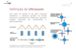 Sua ação no tecido se dá pela natureza
mecânica: a vibração gerada no tecido
promove a oscilação de moléculas, gerando
regiões teciduais de compressão e
descompressão.
Definição de Ultrassom
A implosão das microbolhas provoca um jato potente de gás
(ENERGIA) nelas contido, com pressões de 100 atm/cm2.
 