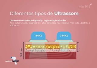 Ultrassom terapêutico (plano) - regeneração tissular
Anti-inflamatório, quando de alta potência, faz lipólise mas não destrói o
adipócito.
Diferentes tipos de Ultrassom
 