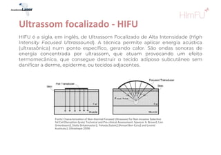 HIFU é a sigla, em inglês, de Ultrassom Focalizado de Alta Intensidade (High
Intensity Focused Ultrassound). A técnica permite aplicar energia acústica
(ultrassônica) num ponto específico, gerando calor. São ondas sonoras de
energia concentrada por ultrassom, que atuam provocando um efeito
termomecânico, que consegue destruir o tecido adiposo subcutâneo sem
danificar a derme, epiderme, ou tecidos adjacentes.
Ultrassom focalizado - HIFU
Fonte: Characterization of Non-thermal Focused Ultrasound for Non-invasive Selective
fat Cell Disruption (lysis): Technical and Pre-clinical Assessment. Spencer A. Brown1, Lior
Greenbaum2, Stella Shtukmaster2, Yehuda Zadok2,Shmuel Ben-Ezra2 and Leonid
Kushkuley2. Ultrashape 2006
 