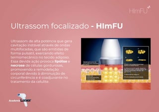 Ultrassom de alta potência que gera
cavitação instável através de ondas
multifocadas, que são emitidas de
forma pulsátil, exercendo efeito
termomecânico no tecido adiposo.
Essa devida ação provoca lipólise e
necrose de células gordurosas,
promovendo a remodelação
corporal devido à diminuição de
circunferência e é coadjuvante no
tratamento da celulite.
Ultrassom focalizado - HImFU
 