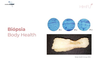 Biópsia
Body Health
Body Health Group, 2014
 