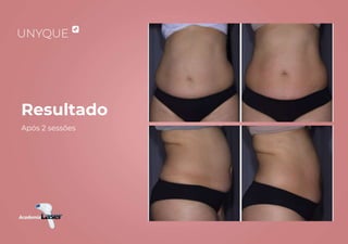 Resultado
Após 2 sessões
 