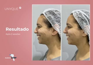 Resultado
Após 2 sessões
 