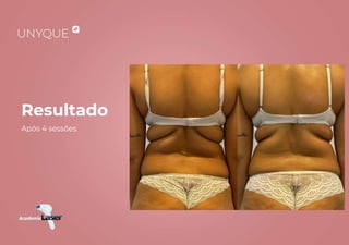 Resultado
Após 4 sessões
 