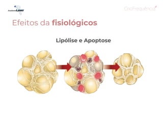 Lipólise e Apoptose
Efeitos da fisiológicos
 