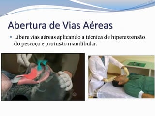 Abertura de Vias Aéreas
 Libere vias aéreas aplicando a técnica de hiperextensão
do pescoço e protusão mandibular.
 