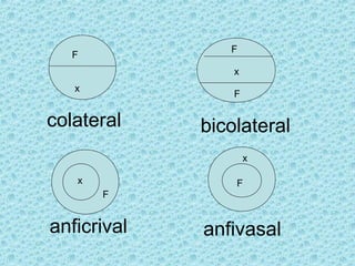x
x
x
x
F
F
F
F
F
colateral bicolateral
anficrival anfivasal
 