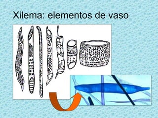 Xilema: elementos de vaso
 