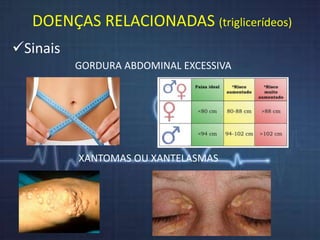 DOENÇAS RELACIONADAS (triglicerídeos) 
Sinais 
GORDURA ABDOMINAL EXCESSIVA 
XANTOMAS OU XANTELASMAS 
 
