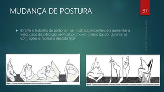 MUDANÇA DE POSTURA
 Drante o trabalho de parto tem se mostrado eficiente para aumentar a
velocidade da dilatação cervical, promover o alívio da dor durante as
contrações e facilitar a descida fetal
37
 
