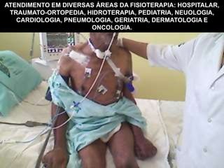 ATENDIMENTO EM DIVERSAS ÁREAS DA FISIOTERAPIA: HOSPITALAR,
TRAUMATO-ORTOPEDIA, HIDROTERAPIA, PEDIATRIA, NEUOLOGIA,
CARDIOLOGIA, PNEUMOLOGIA, GERIATRIA, DERMATOLOGIA E
ONCOLOGIA.
 