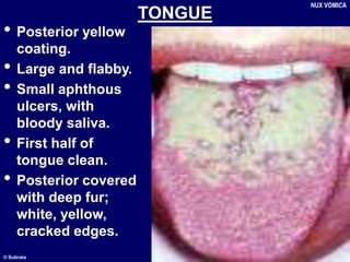 © Subrata
TONGUE
• Posterior yellow
coating.
• Large and flabby.
• Small aphthous
ulcers, with
bloody saliva.
• First half of
tongue clean.
• Posterior covered
with deep fur;
white, yellow,
cracked edges.
NUX VOMICA
 
